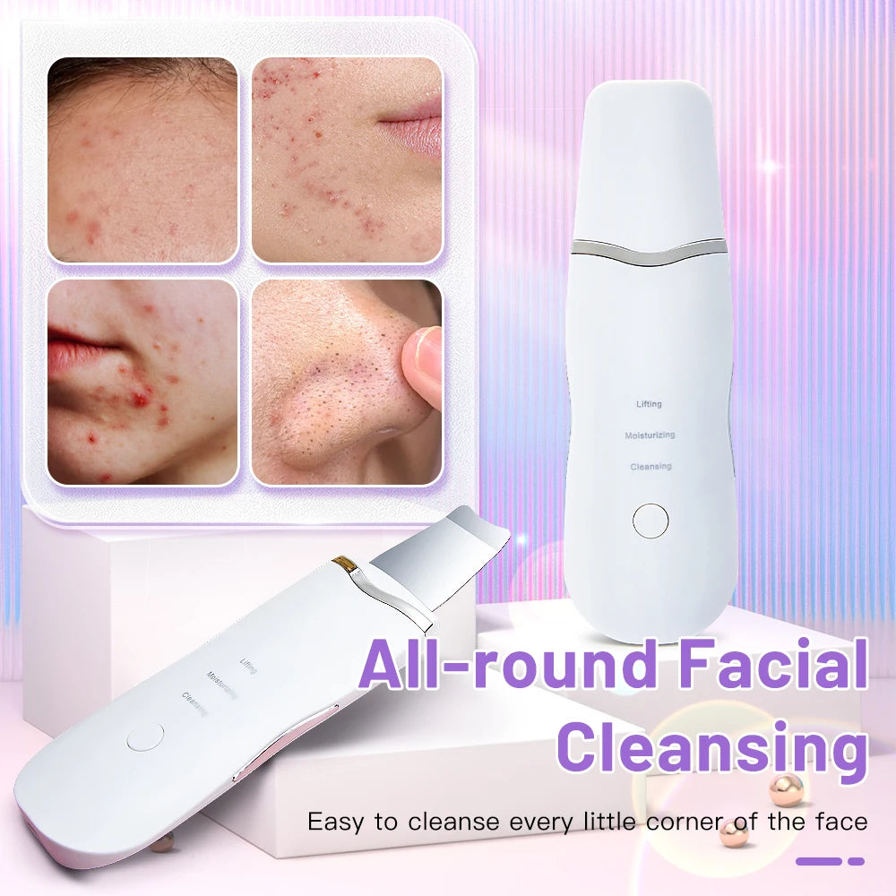 Electric Ultrasonic Skin Scrubber Vibration Face Spatula Peeling